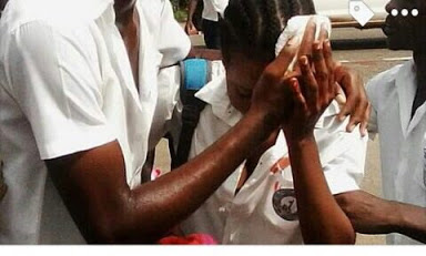 L'image de la fille blessée